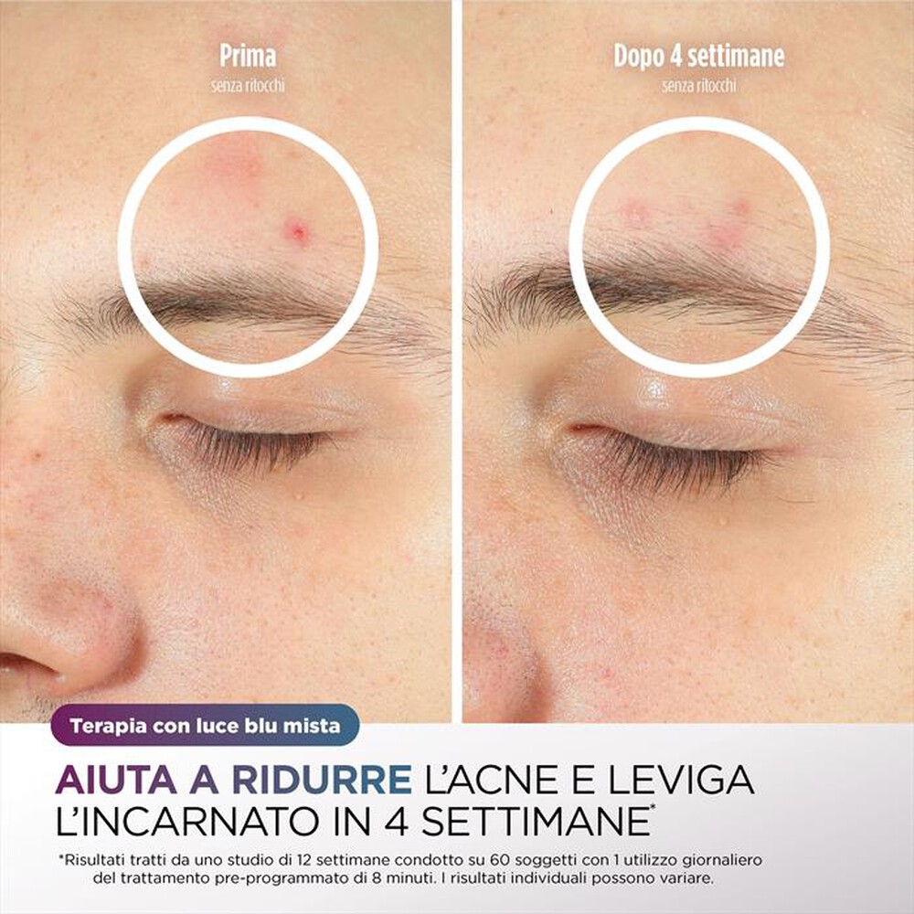 Immagine del prodotto SHARK - CRYOGLOW MASCHERA VISO LED-Bianco