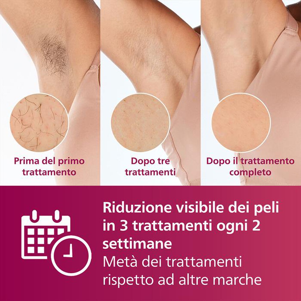 Immagine del prodotto PHILIPS - Epilatore a luce pulsata LUMEA BRI920/00