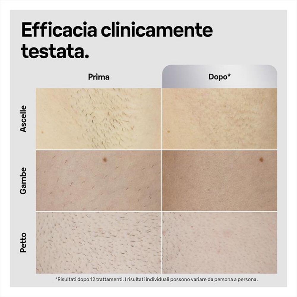 Immagine del prodotto BRAUN - LUCE PULSATA PL5145-BIANCO/ARGENTO